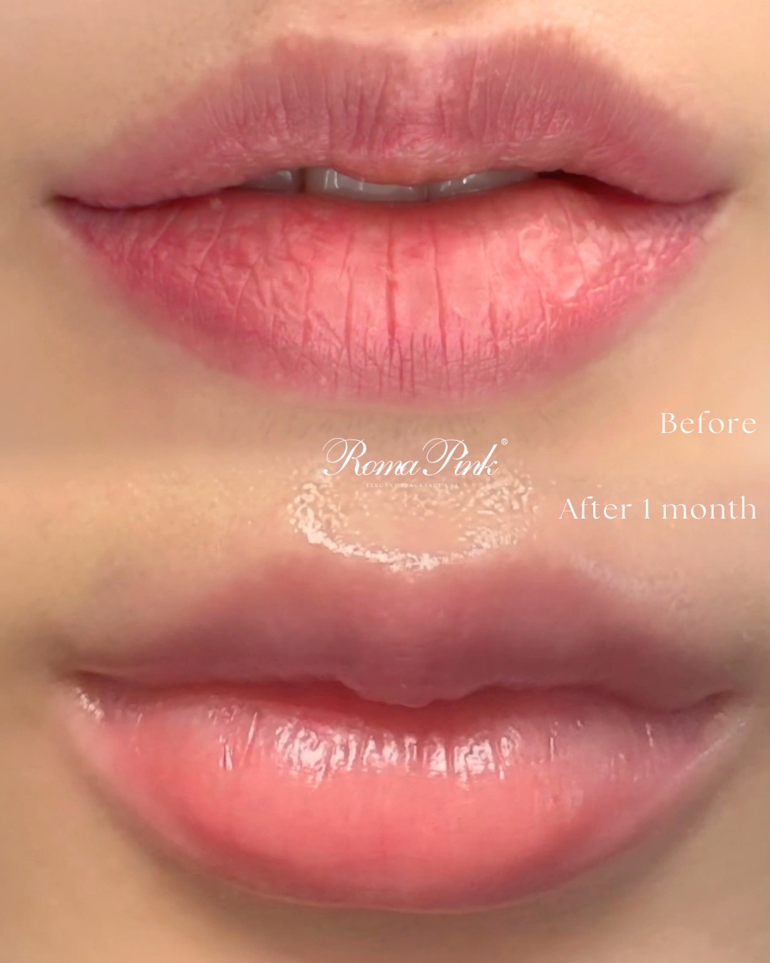 広島 ローマピンクの施術を体験！ | Rudaルーダ| 広島 マツパ スカルプ